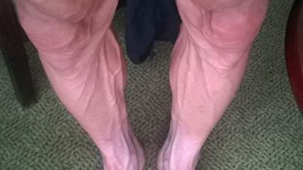 Bartosz Huzarski legs