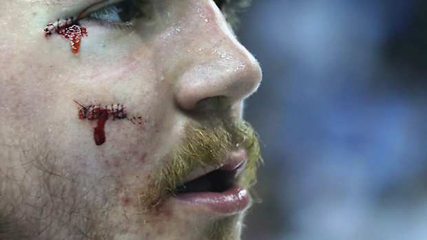 andrew-shaw-stitches-auction.jpg