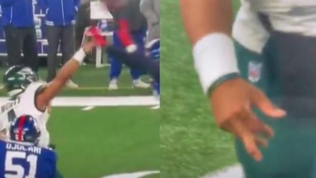 Jalen Hurts' injured finger