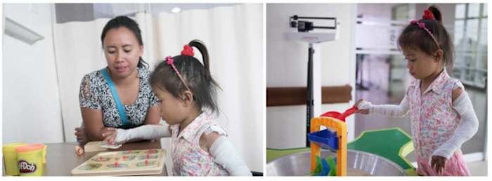 Jocy, a patient who underwent surgery for severe burns at the Tebow CURE hospital in the Philippines.