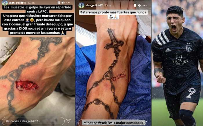 Image placeholder title