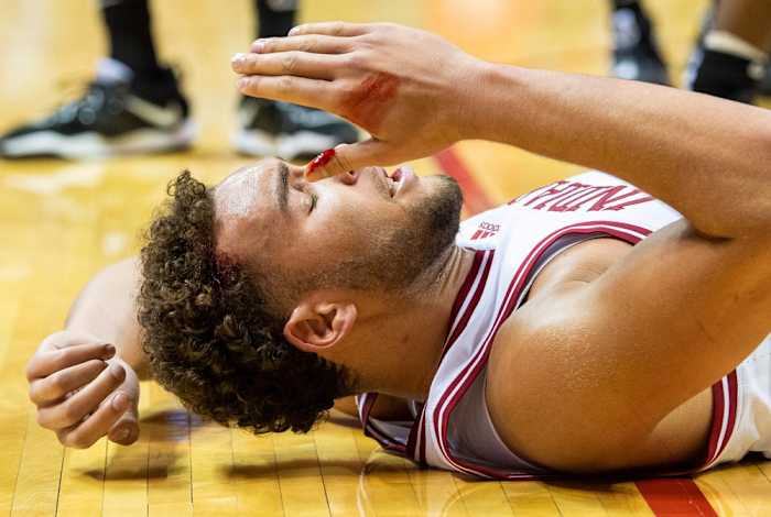 Indiana forward Race Thompson took and elbow to the head that drew blood, but he came back in the game and finished with 20 points. (USA TODAY Sports)