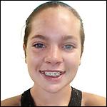 Image placeholder title