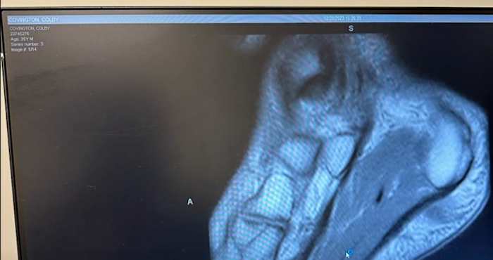 Covington's name can be seen in the top-left of the X-Ray.