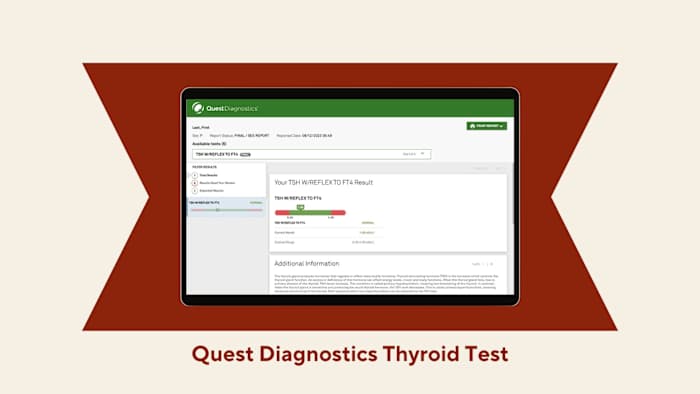 A red and beige background with a computer screen showing results from the Quest Diagnostics at home thyroid test kit